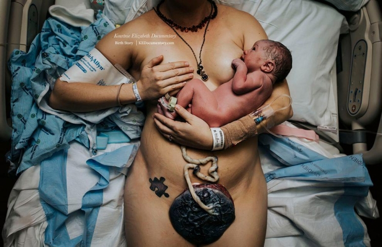 Шокирующие фото с конкурса фотографий родов «Birth Photo Competition 2017», показывающие через что проходят мамы
