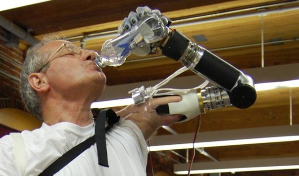 В США одобрили использование роботизированной руки Люка